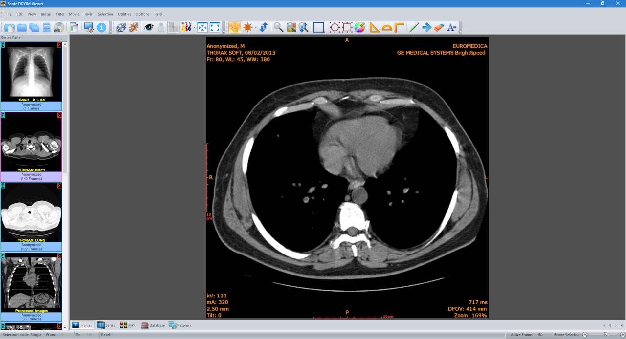 RadiAnt DICOM Viewer(ҽѧͼ) v2020.1 °