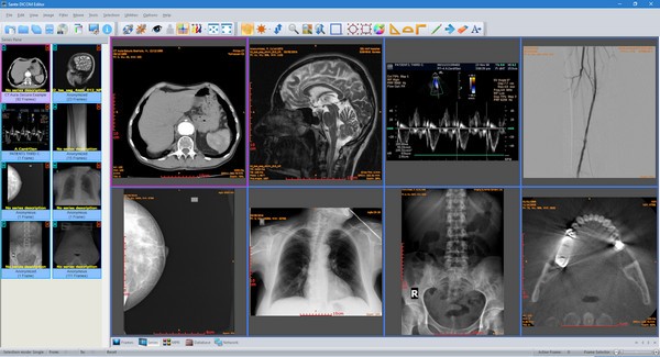 Sante DICOM Editorʽv7.8.6